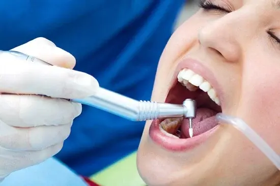 سعر حشو العصب والطربوش