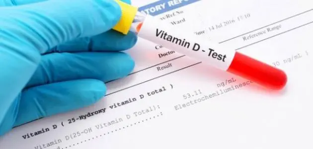 سعر تحليل فيتامين د 