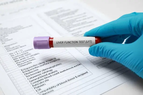 سعر تحليل وظائف وإنزيمات الكبد