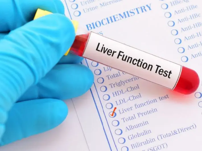 سعر تحليل وظائف وإنزيمات الكبد