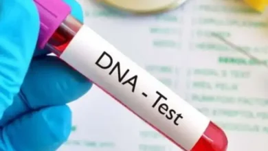 سعر تحليل DNA في الكويت