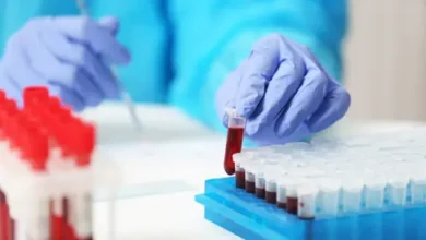سعر تحليل Calprotectin في معمل البرج