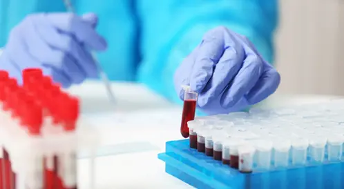 سعر تحليل Calprotectin في معمل البرج