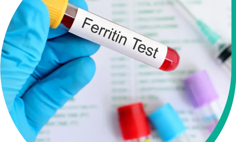 سعر تحليل Serum Ferritin