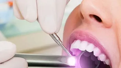 سعر حشو العصب والطربوش