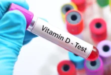 سعر تحليل فيتامين د