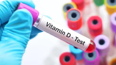سعر تحليل فيتامين د