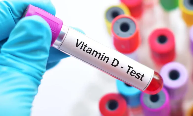 سعر تحليل فيتامين د