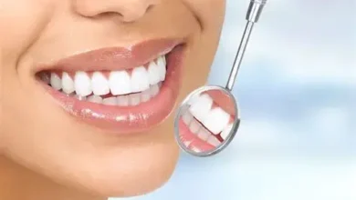 سعر ابتسامة هوليود في السعودية