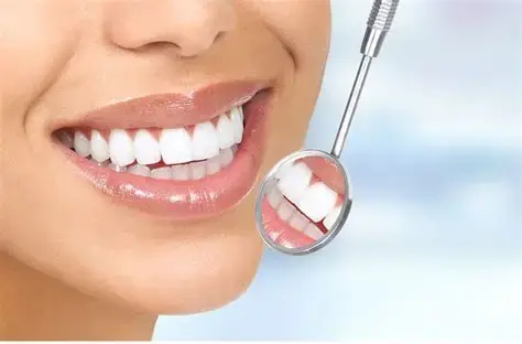 سعر ابتسامة هوليود في السعودية