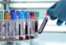 سعر تحليل دلالات الأورام