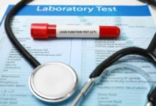 سعر تحليل وظائف وإنزيمات الكبد